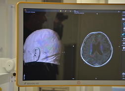 Podczas zabiegu na bieżąco będzie monitorowana praca mózgu