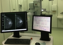 Cyfrowy aparat RTG do mammografi pozwala na wczesne wykrycie raka piersi