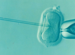 mikroskopowe zdjęcie zapładnianej komórki metodą in vitro