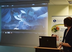 na ekranie widać lekarzy przeprowadzających operację, slajd omawia ekspert